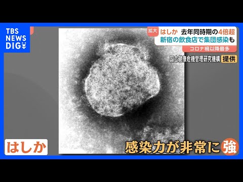 コロナ禍以降で最多…はしかが感染拡大　感染者が去年同時期の4倍超に　肺炎や中耳炎の恐れも【Nスタ】｜TBS NEWS… サムネイル