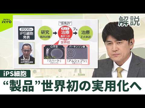【解説】iPS細胞「早期承認」を了承…今後7年かけ有効性・安全性を確認 サムネイル