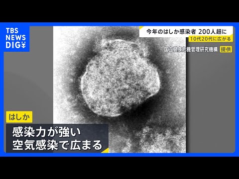 「はしか」感染広がる　10代…32%、20代…25%　今年の感染者236人（今月5日時点）｜TBS NEWS DIG サムネイル