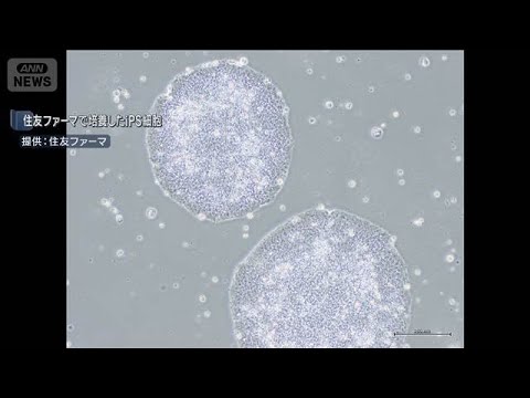 【速報】iPS細胞使った再生医療2製品　厚労省の専門部会が製造販売を了承　世界初へ(2026年2月19日) サムネイル