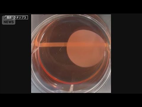 “仮免許”→“本免許”への道のりは？世界初『iPS細胞由来』条件付き承認へ【報道ステーション】(2026年2月19日) サムネイル