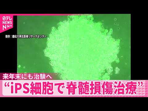 【世界初】慶応大学発ベンチャー企業 来年末にも治験へ “iPS細胞で脊髄損傷治療” サムネイル