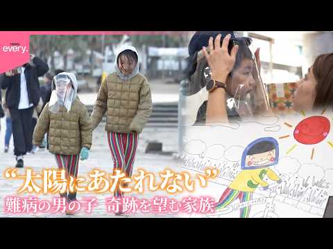 【難病】“太陽にあたれない”男の子  限られた時間…奇跡を望む家族『every.特集』 サムネイル
