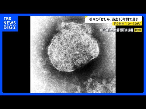 10年間で過去最多の132人 　都内の「はしか」感染者　10代～30代が9割近く｜TBS NEWS DIG サムネイル