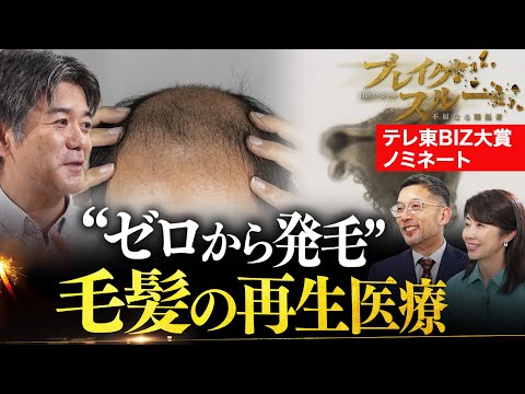 世界初の薄毛治療“毛髪再生医療”で自分の髪を“ゼロから発毛”【ブレイクスルー】【テレ東BIZ大賞2025ノミネート作品】 サムネイル