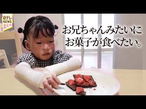 ”難病の少女” のために医師が作ったチョコ / なぜ私が…若年性認知症と共に生きる人々 など【知ってほしい私のこと】（… サムネイル