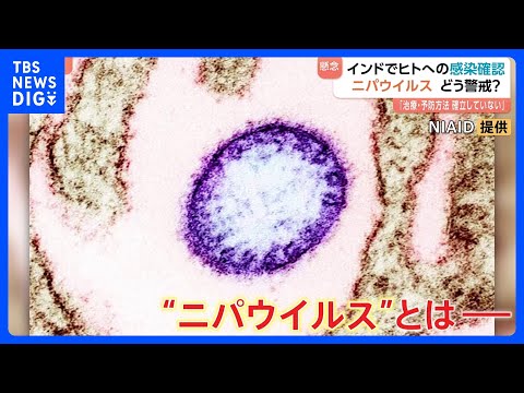 「ニパウイルス」インドでヒトへの感染確認　現地在住の日本人「気をつけなきゃいけないなというレベルで生活」 アジア各国で… サムネイル