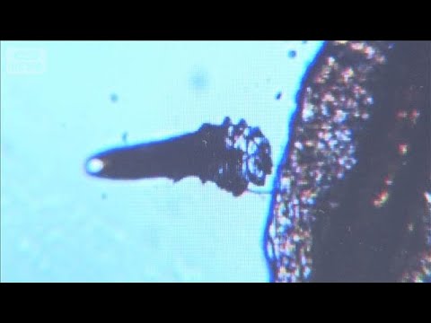 目のゴロゴロ「まつげダニ」？結膜炎＆ものもらい原因も　加齢とともに有病率が上昇【もっと知りたい！】【グッド！モーニング… サムネイル