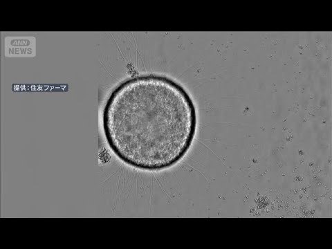 世界初の製品誕生へ　厚労部会がiPS細胞の再生医療製品の製造販売を了承(2026年2月20日) サムネイル