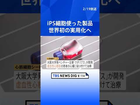 iPS細胞を使った再生医療製品が“世界初”の実用化へ 「条件・期限付き」で製造販売を了承　心臓病・パーキンソン病治療の… サムネイル