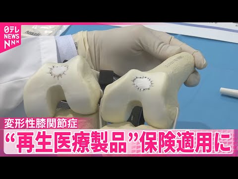 【自家培養軟骨「ジャック」】変形性膝関節症の“再生医療製品”保険適用に サムネイル